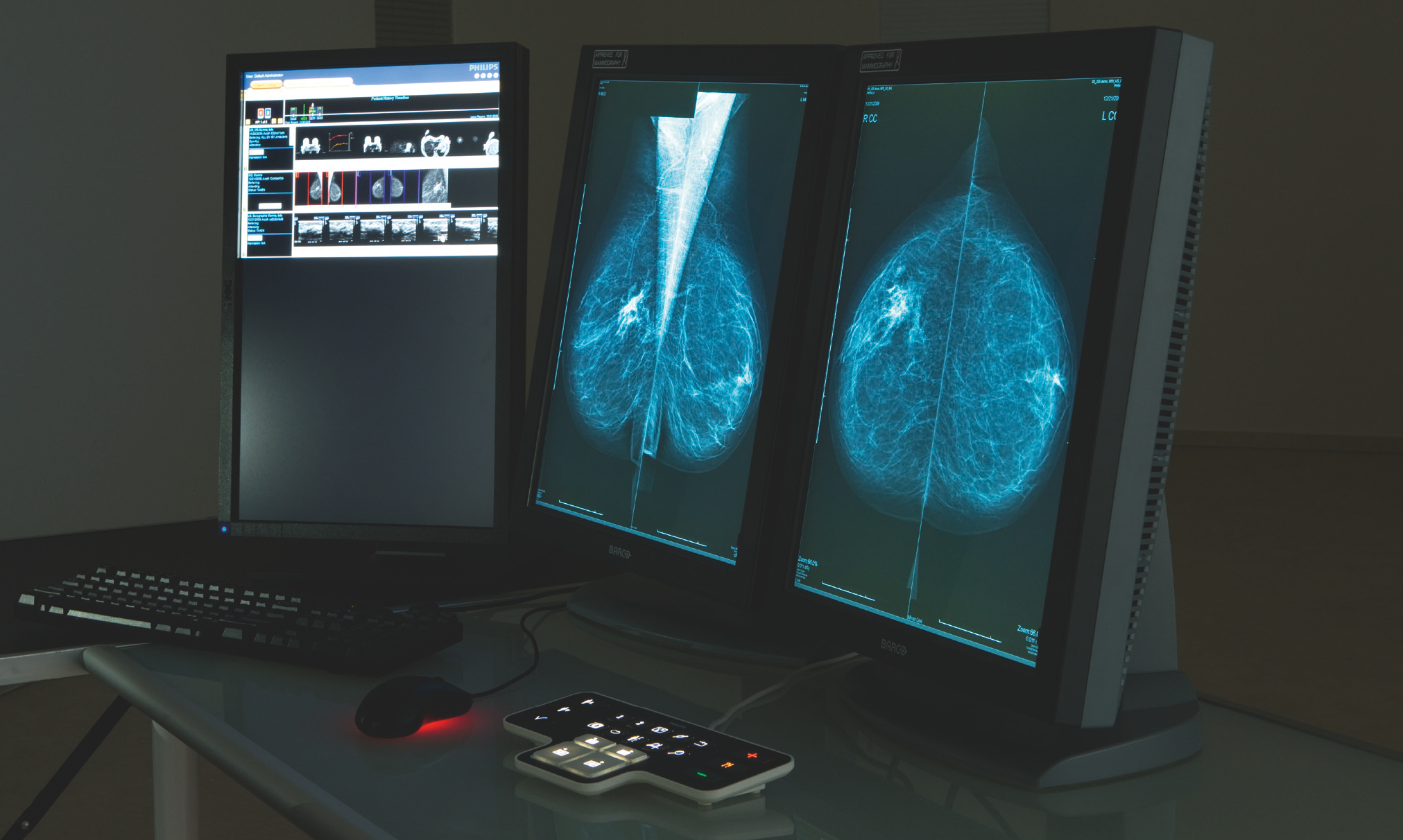 Servicios de Gnostika Mamografia Servicios de Gnostika Mamografia