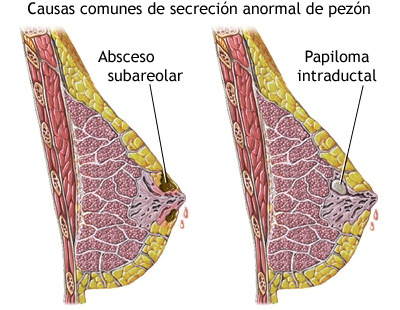 Mamografía examen